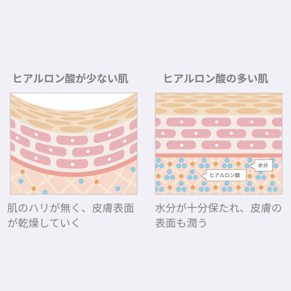 pull バランストナー